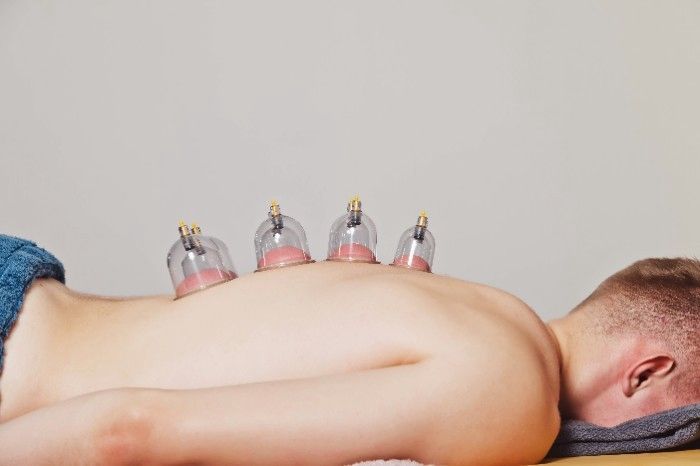 Ventosaterapia nas costas